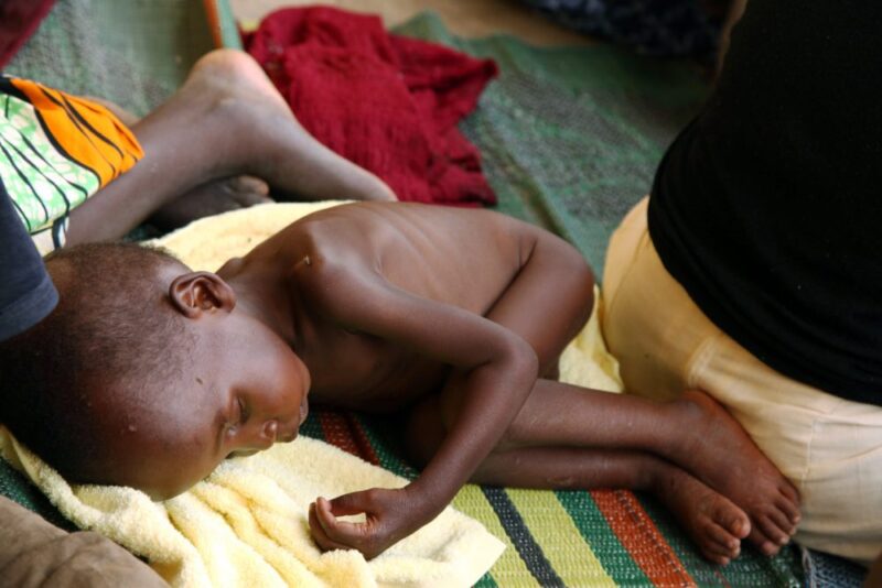 A malnourished child rescued by Nigerian soldiers from the Islamist militants Boko Haram