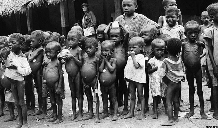 starvation biafra children hunger 2