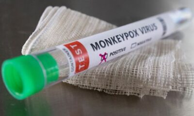 Monkeypox Test