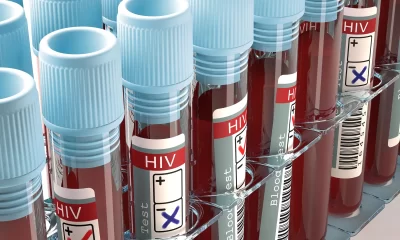 HIV-AIDS-virus