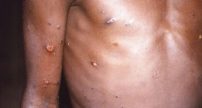 Skinpox