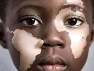 Africa and the African child