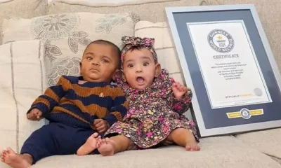 World’s most premature babies celebrate first birthday