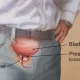 Solution to prostate challenges