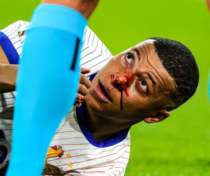 Mbappe
