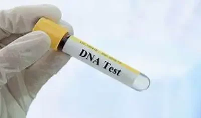 dna-test