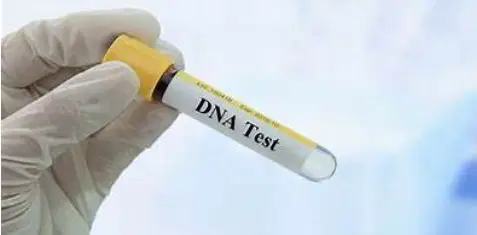 dna-test