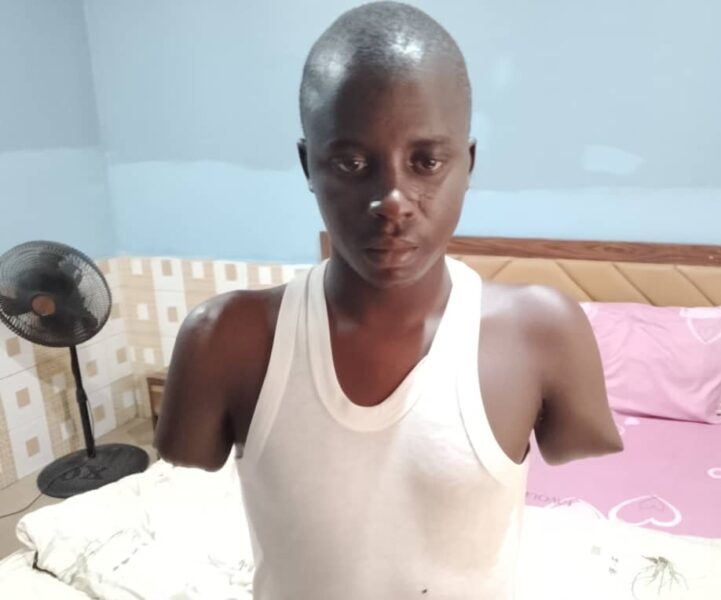 Sharia law and amputation