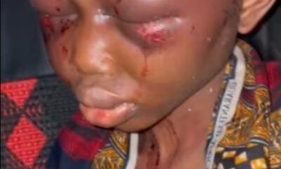 Lady beaten up on accusations of witch craft