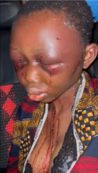 Lady beaten up on accusations of witch craft